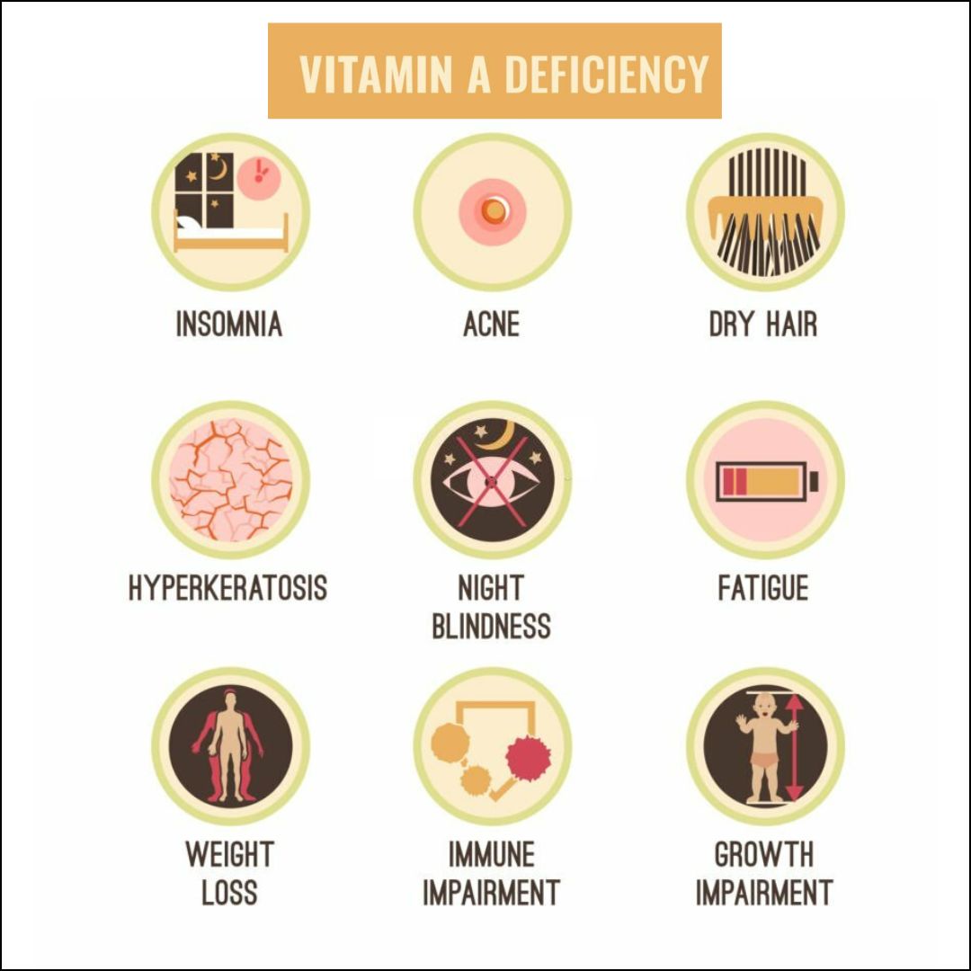 Signs Of Vitamin Deficiencies In Adults Unveiled